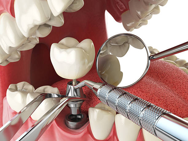 Best Emergency Broken Tooth Repair in Haskell, AR