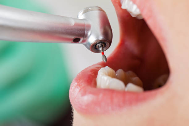 Best Walk-In Emergency Dentist in Haskell, AR